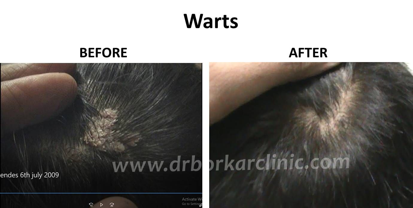 Results – Dr Borkar’s Clinic